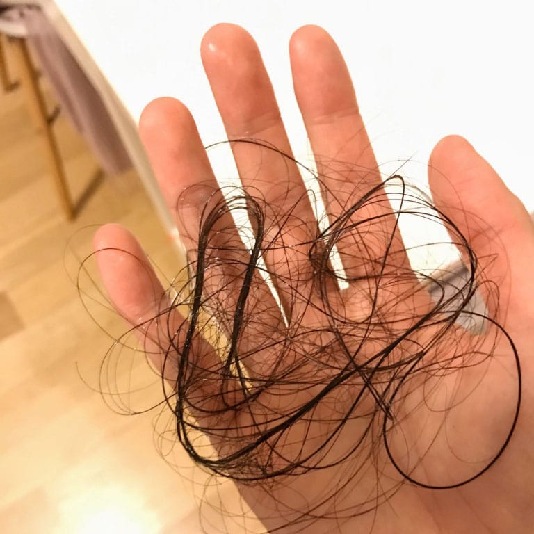 Hair loss from meds - achronicvoice.com