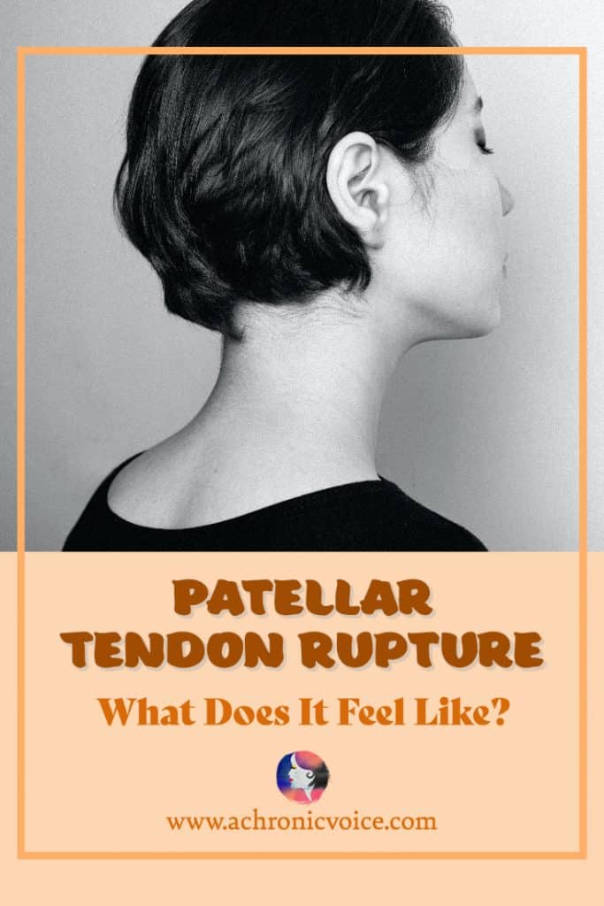 What Does a Patellar Tendon Rupture Feel Like?